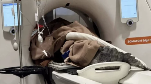 Crocodile Bill's CT scan