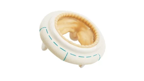 Mosaic Neo mitral valve from Medtronic