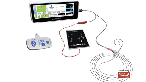 The SoloPace Fusion Temporary Pacing System from Solo Pace Inc. is deigned to eliminate the need for right ventricular (RV) lead placement, which requires the added procedural step to gaining venous access. This can cut procedure time and mitigate possible complication risks. For interventional cardiologists using improvised left ventricular (LV) pacing, this system can replace ad-hoc clip assemblies, subcutaneous needles and exposed wire connections, which are known sources of inconsistent pace capture. 