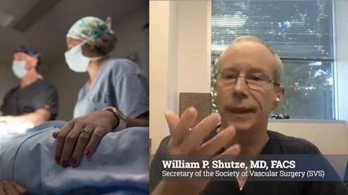 William P. Shutze, MD, FACS, secretary of the Society of Vascular Surgery (SVS), a vascular surgeon with Texas Vascular Associates in Plano, Texas, and a clinical associate professor of medicine at Texas A&M College of Medicine, explains the goals of the SVS quality assessment program. 