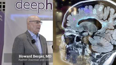Howard Berger, MD, RadNet chairman and CEO, discusses why the company has invested millions into DeepHealth to rapidly build up a new business model for artificial intelligence capabilities in radiology. #RSNA #HealthAI #ClinicalAI #Radiology
