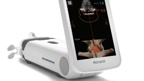 Accuro POCUS musculoskeletal system