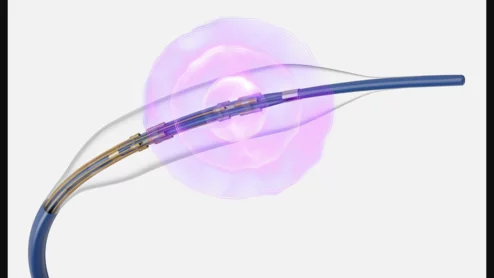 Boston Scientific’s Seismiq 4CE Coronary IVL Catheter