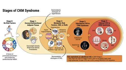 The stages of cardiovascular-kidney-metabolic syndrome that was included in the new ACC-AHA CKM syndrome guideline.