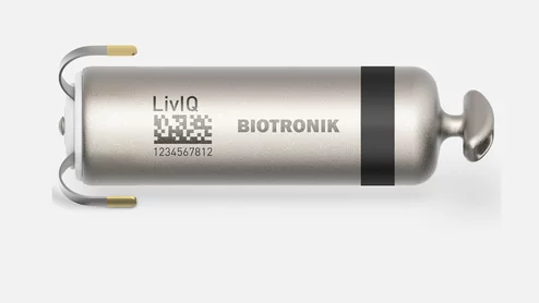  Biotronik's LivIQ leadless pacemaker offers a single-device solution designed to deliver atrioventricular (AV) synchrony through advanced electrical atrial far-field sensing. 