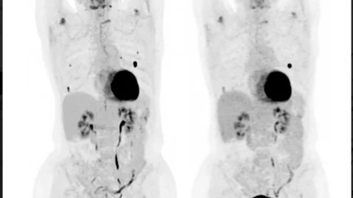 Whole-body PET system reduces image acquisition time.