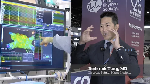 Roderick Tung explains cardio-neuro ablation therapy for recurrent vasovagal syncope