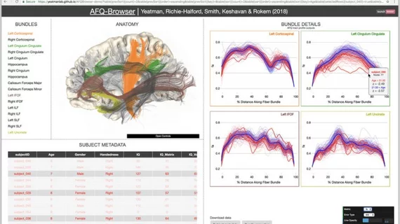 afq-browser_screencap-750x464.jpg