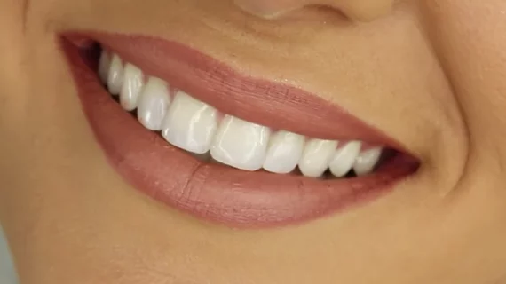 teeth