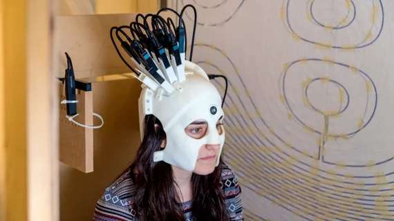new-brain-scanner-1-credit-wellcome-1024x576.jpg