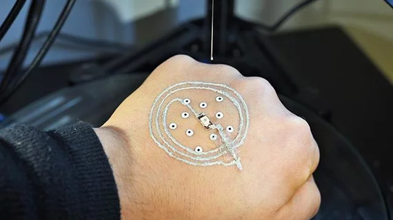 3D printing