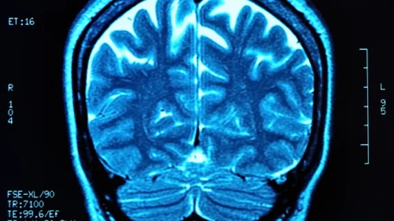 brain42.jpg