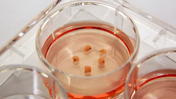 Brain Organoids
