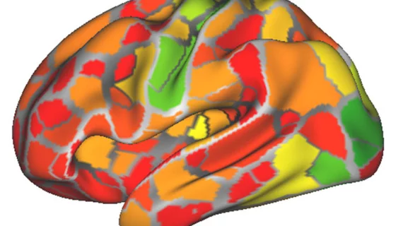 fcmri_indiv_diff_forweb-700x467.jpg