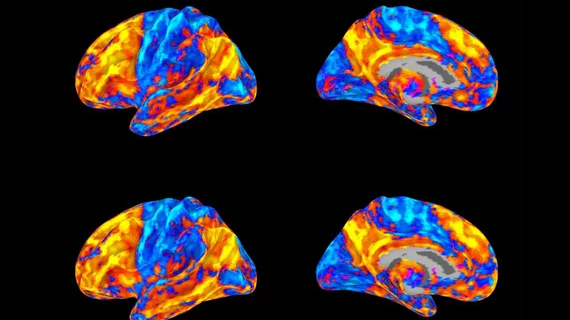 brainconnectivity_dt.jpg