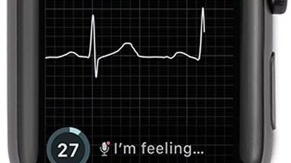 AliveCor's KardiaBand with Apple smartwatch