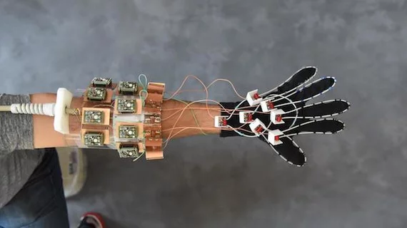 MRI glove