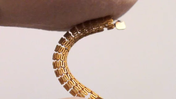 Smart stent UBC