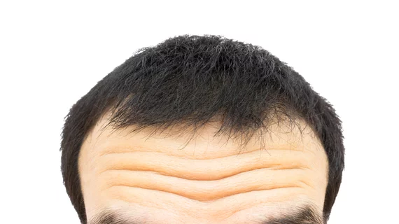 Wrinkled forehead | Furrowed brow