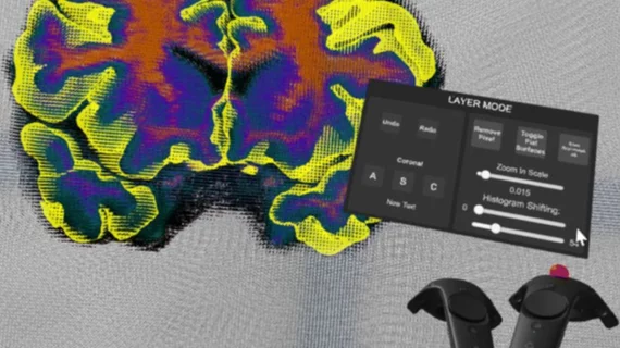 virtual-brain-segementer-web-824x549.jpg