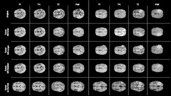 Nvidia brain scans