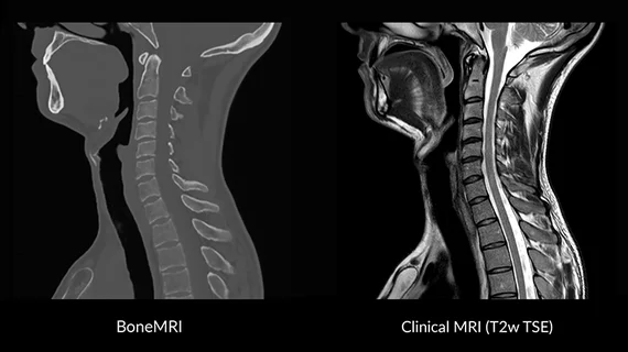 clinical-mri-t2w-tse.jpg
