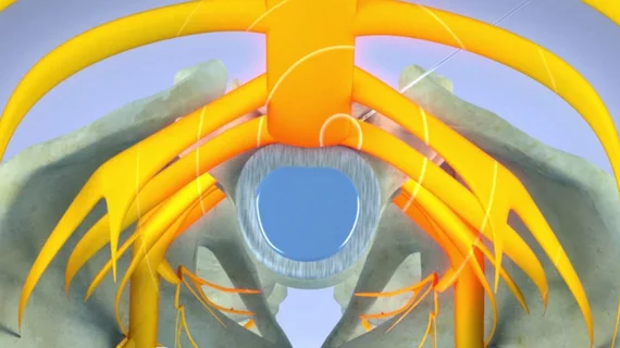 Pulsed Radiofrequency