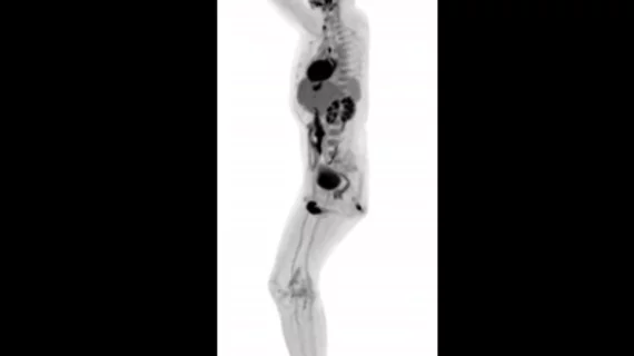 Full-body MRI