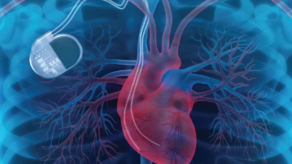 heart_device.png