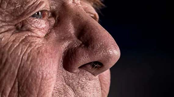 Nose