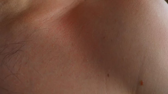 dermatology