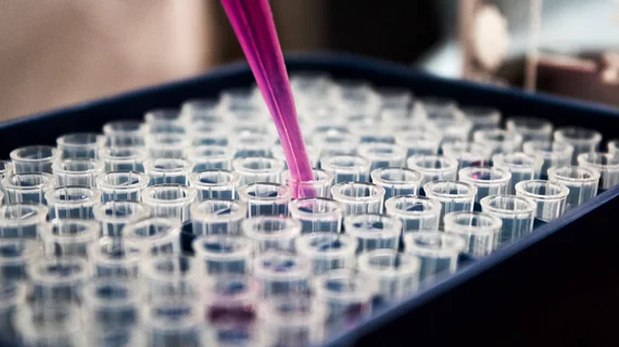 Lab Experiment