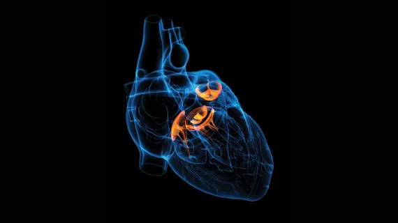 heart.jpg