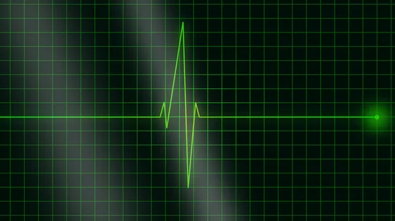 ECG