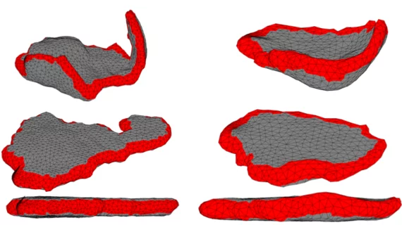 1unflattened_top_versus_flattened_middle_and_bottom.png