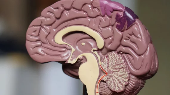 Brain
