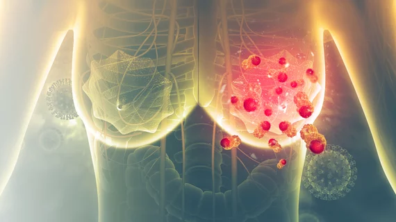 Researcher considers greater role of AB-MRI for patients with personal history of breast cancer