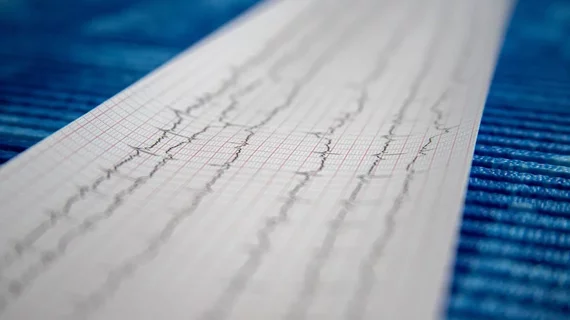 ECG rhythm strip from a 6-lead ECG