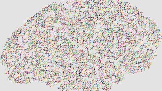 Brain