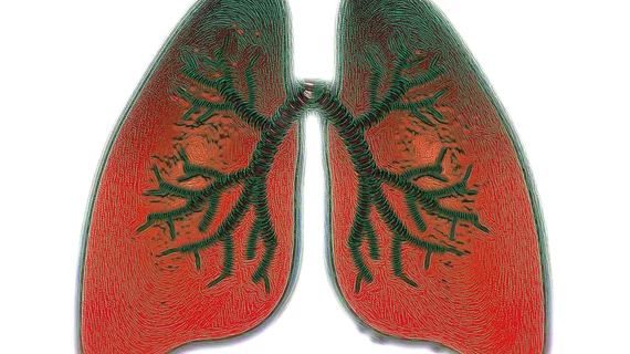 Lungs
