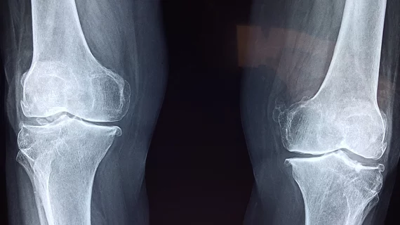 knee x-ray