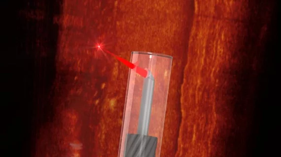 Endoscope