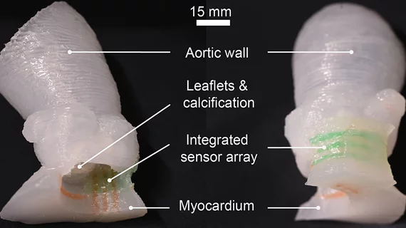 heart valve 3d printed