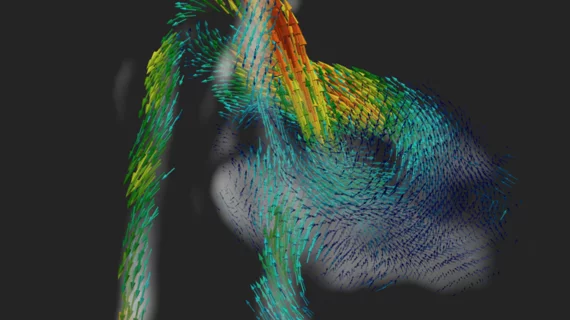 4d fetal MRI