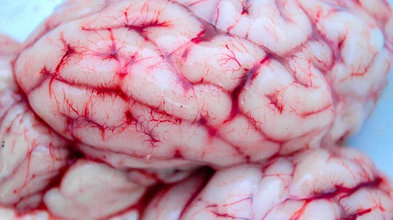 Brain