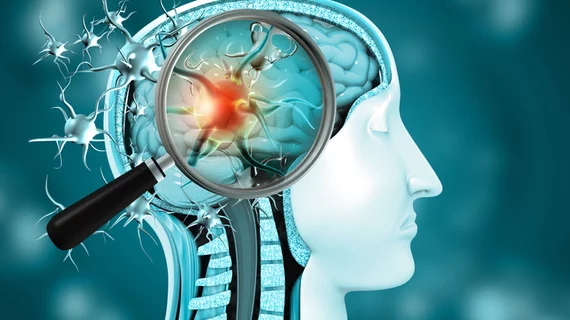 brain virus