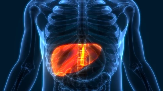 liver cancer