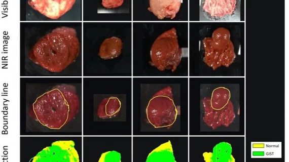 Hyperspectral imaging