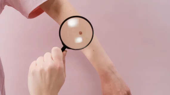skin_cancer.jpg