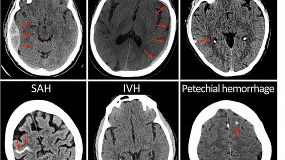 nih-brain_copy.jpg